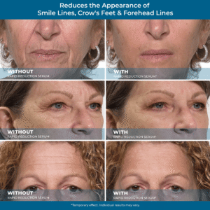 Rapid Reduction Serum