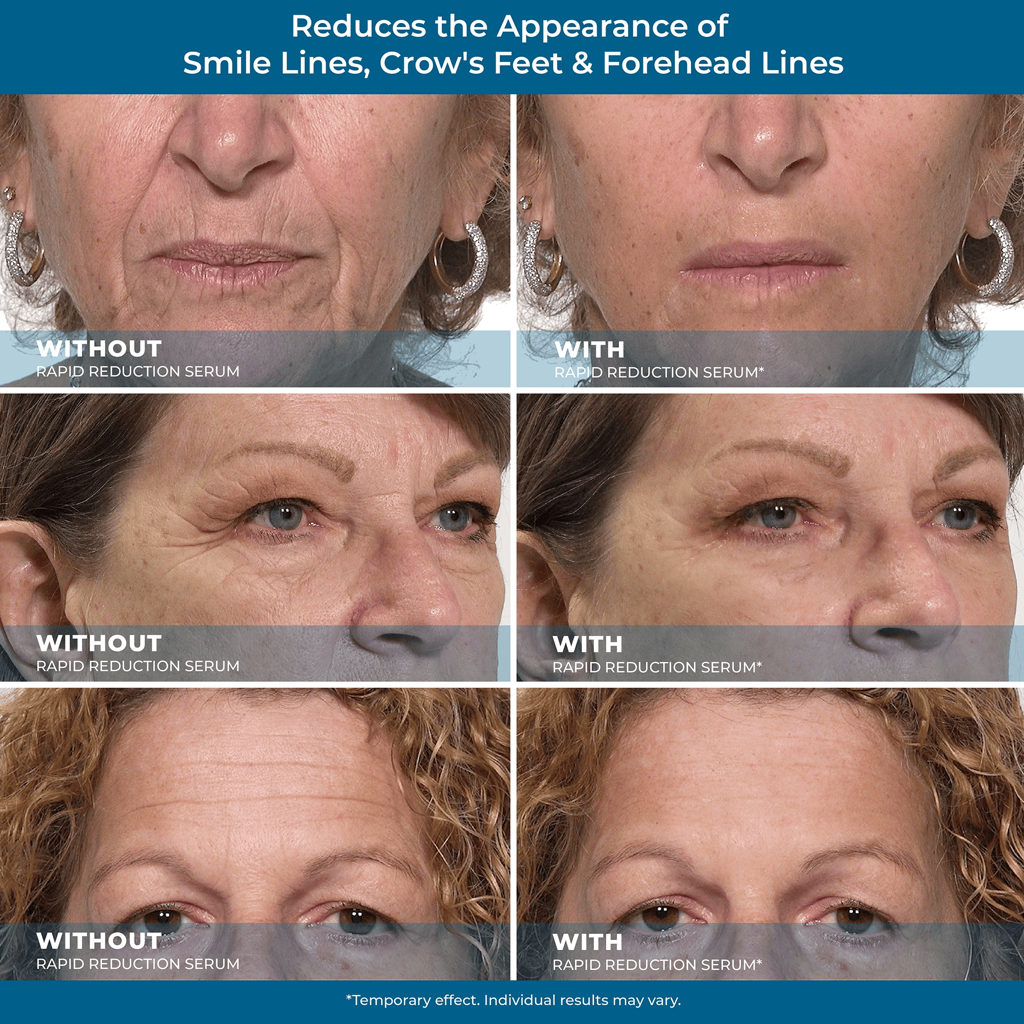 Rapid Reduction Serum